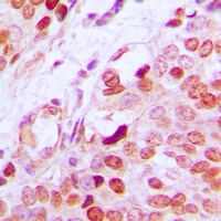 Anti-GATA1 (Phospho-S142) Antibody