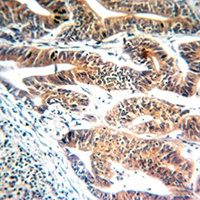 Anti-GBP1 Antibody