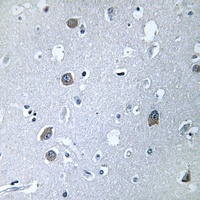 Anti-GNAL Antibody