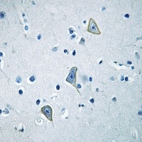 Anti-GPR158 Antibody