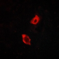 Anti-GPR158 Antibody