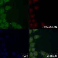 Anti-NMDAR2D Antibody
