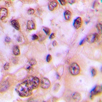 Anti-GSK3 beta (Phospho-S9) Antibody