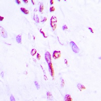 Anti-Histone H2B (Acetyl-K5) Antibody