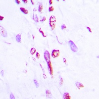 H2BFS antibody