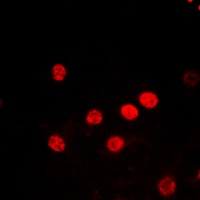 Anti-Histone H2B (Acetyl-K5) Antibody