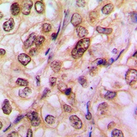 Anti-Histone Deacetylase 5/9 (Phospho-S259/220) Antibody