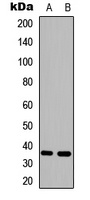 HSD11B1 Rabbit Polyclonal Antibody