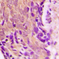 Anti-HSP90 beta Antibody