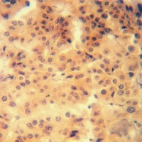 Anti-5-HT1F Antibody