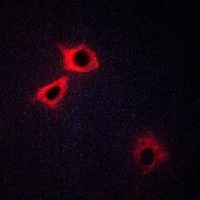 Anti-5-HT1F Antibody