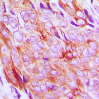 Anti-IGF1 Receptor (Phospho-Y1161) Antibody