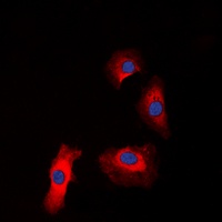 IGF1R (Phospho-Y1161) antibody