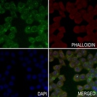 IL13RA2 antibody