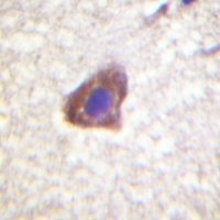 Anti-CD130 Antibody
