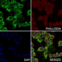 Anti-CD130 Antibody
