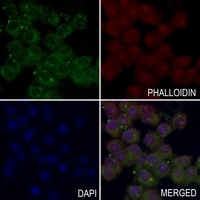 Anti-Inhibin beta B Antibody