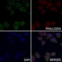 INSR (Phospho-Y1355) antibody