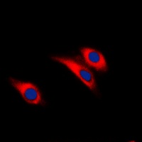 INSR (Phospho-Y1361) antibody