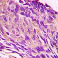 Anti-IRS1 (Phospho-S307) Antibody