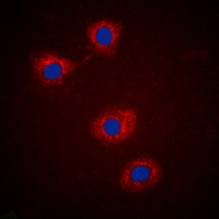 Anti-IRS1 (Phospho-S307) Antibody