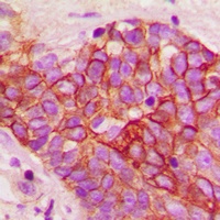Anti-CD29 (Phospho-T789) Antibody