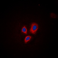 Anti-CD29 (Phospho-T789) Antibody