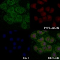 Anti-CD61 (Phospho-Y785) Antibody