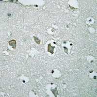 Anti-Kir2.1 Antibody