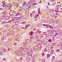 Anti-PRKD1/2/3 (Phospho-S738/S742) Antibody