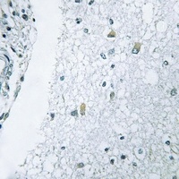 Anti-Laminin gamma 3 Antibody