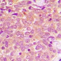 Anti-MKK1 Antibody
