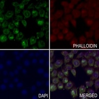 Anti-MKK1 Antibody