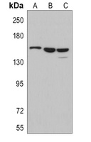 MEKK1 Rabbit Polyclonal Antibody