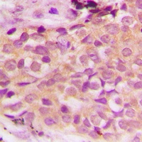 Anti-ASK1 (Phospho-S966) Antibody