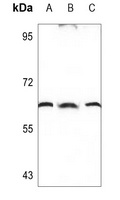 TPL2 Rabbit Polyclonal Antibody
