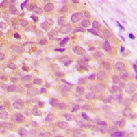 Anti-TPL2 Antibody