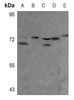 TAU Rabbit Polyclonal Antibody