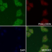 TAU Rabbit Polyclonal Antibody