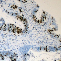 Anti-TRAP220 (Phospho-T1457) Antibody