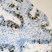 MED1 (Phospho-T1457) antibody