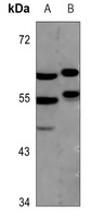 MEF2A Antibody