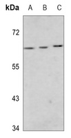 MEF2D (Phospho-S444) Antibody