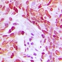 Anti-MEF2D (Phospho-S444) Antibody