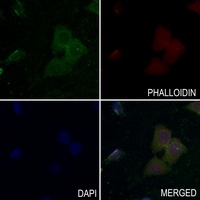 Anti-c-Met (Phospho-Y1349) Antibody