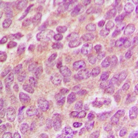 Anti-MFN2 Antibody