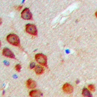 Anti-MEKKK6 Antibody