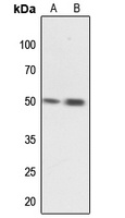 MNK1 Rabbit Polyclonal Antibody