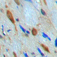 Anti-MNK1 Antibody
