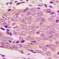 Anti-MRPL51 Antibody